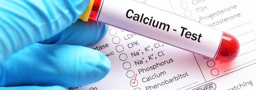 בדיקת רמת סידן - תמונה